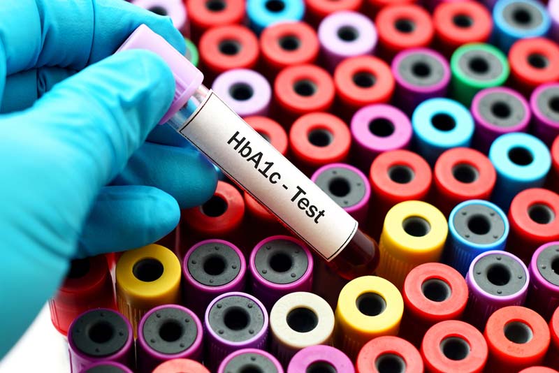 Hemoglobin A1c Levels test