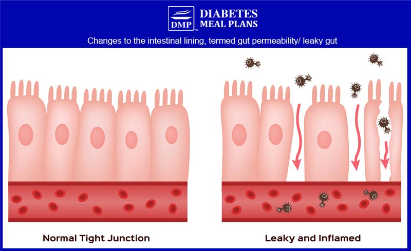 Leaky Gut/ Intestinal Permeability