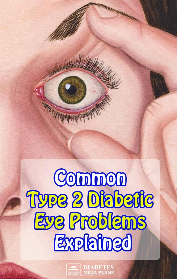 Common Diabetic Eye Problems Explained