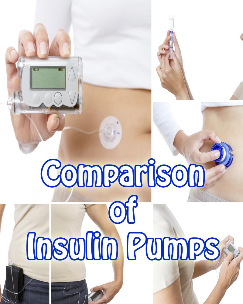 Insulin Pump Comparison Chart My Xxx Hot Girl 