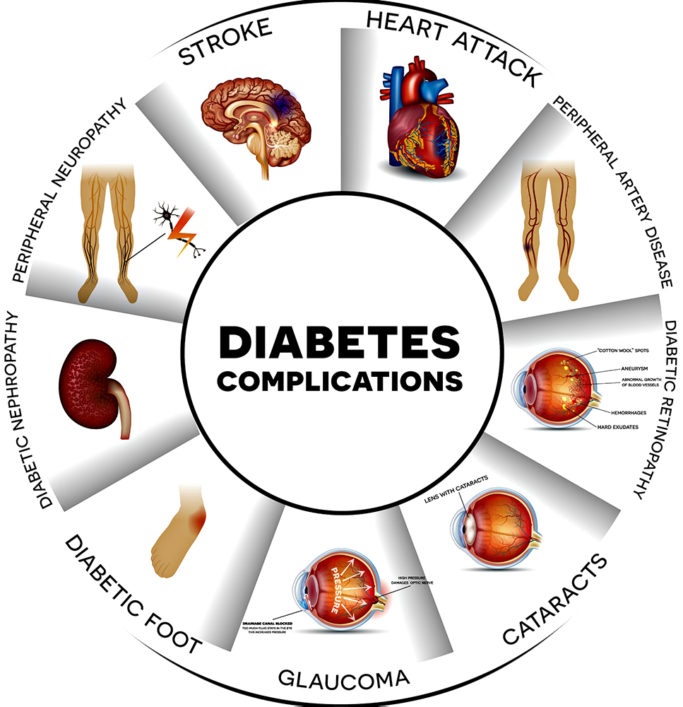 How Does Diet Help Type 2 Diabetes