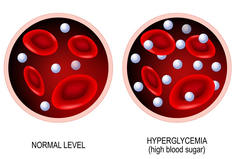 Blood glucose levels before and after eating